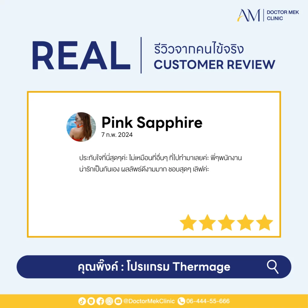 Thermage FLX Review-01