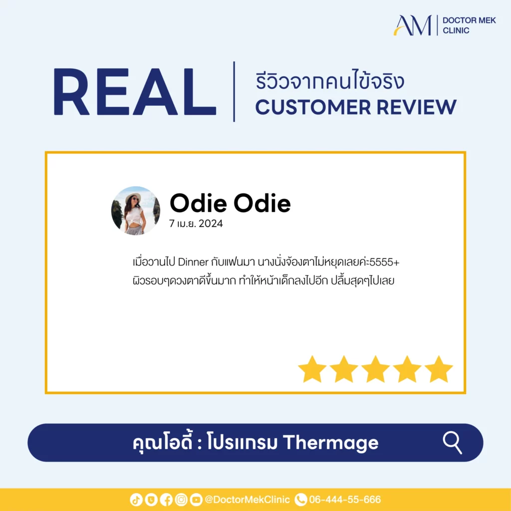 Thermage FLX Review-02