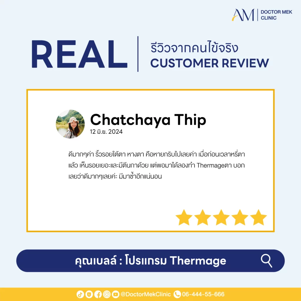 Thermage FLX Review-03