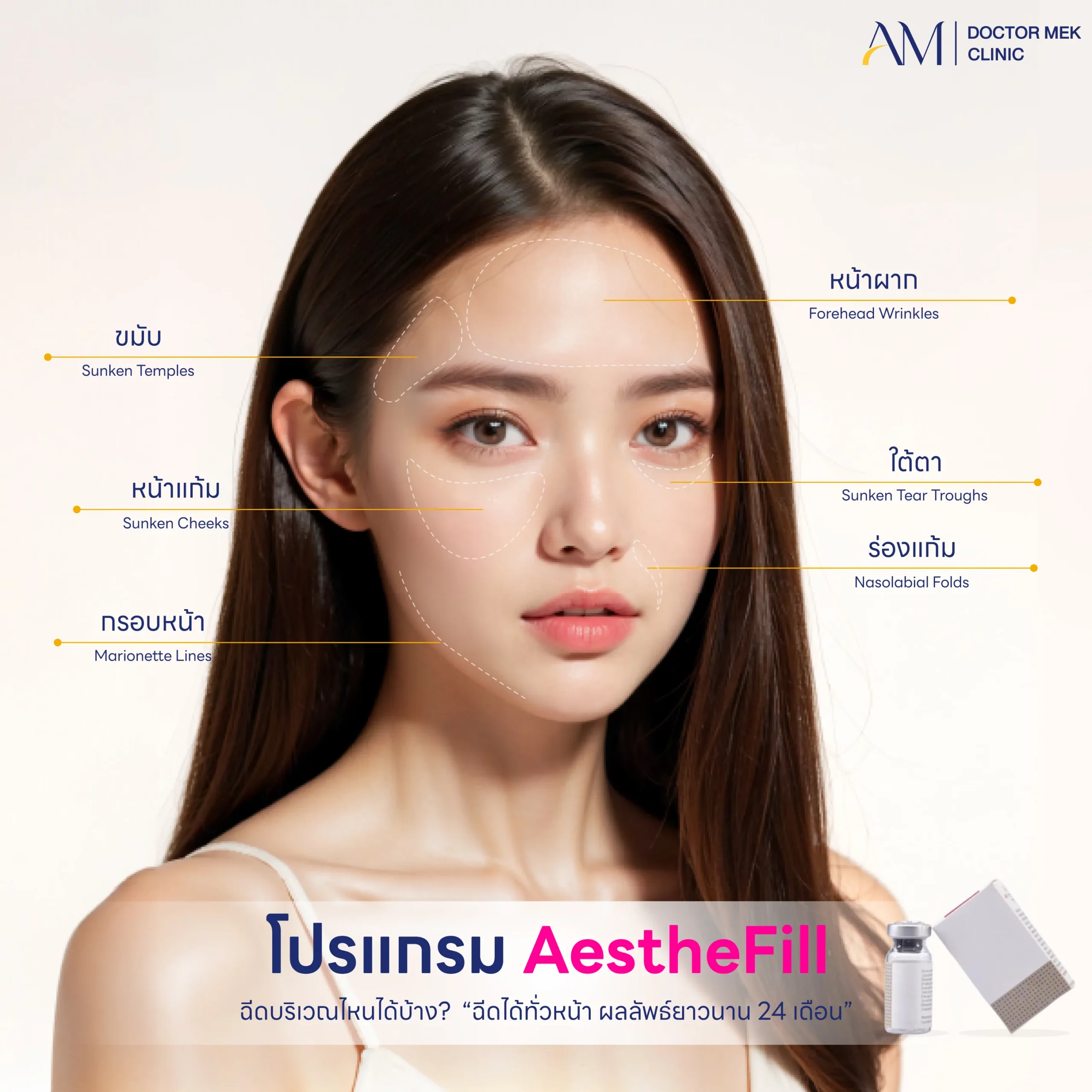 โปรแกรม AestheFill ฉีดบริเวณไหน-01